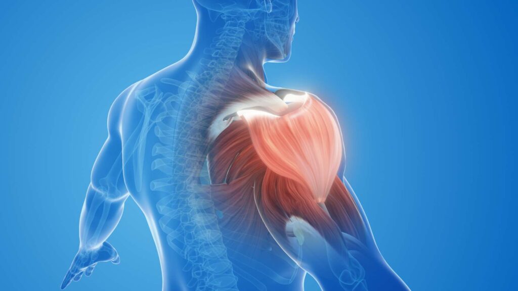 Delayed-Onset Injuries 